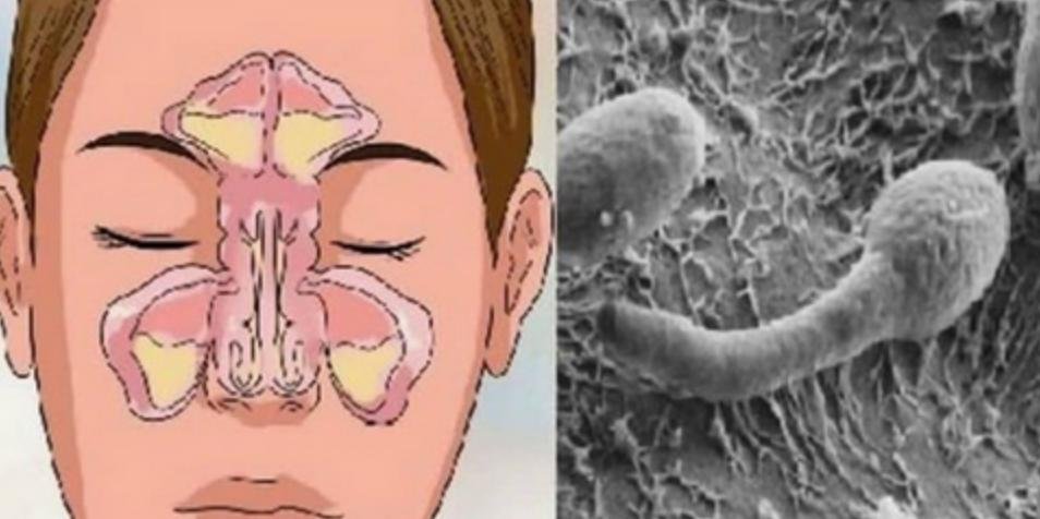 Постоянно заложен нос? Причину следует искать в кишечнике