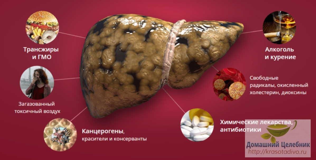 Как разгрузить печень? Можете болеть и не знать причины!