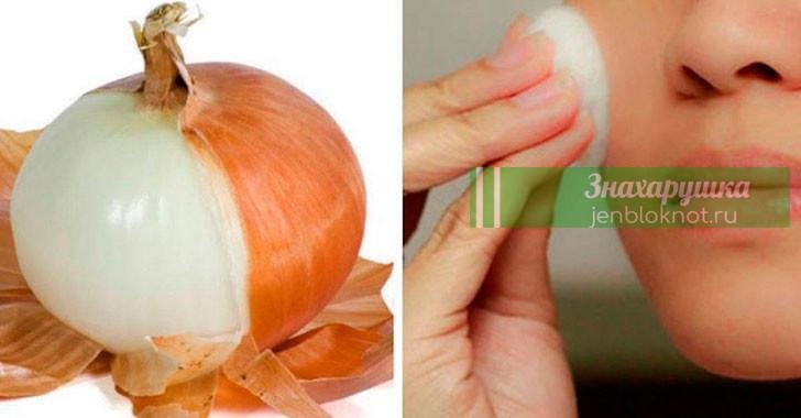 Избавиться от заболеваний почек, мочевого пузыря, ринита, бронхита, выпадения волос легко, если знать этот простой рецепт