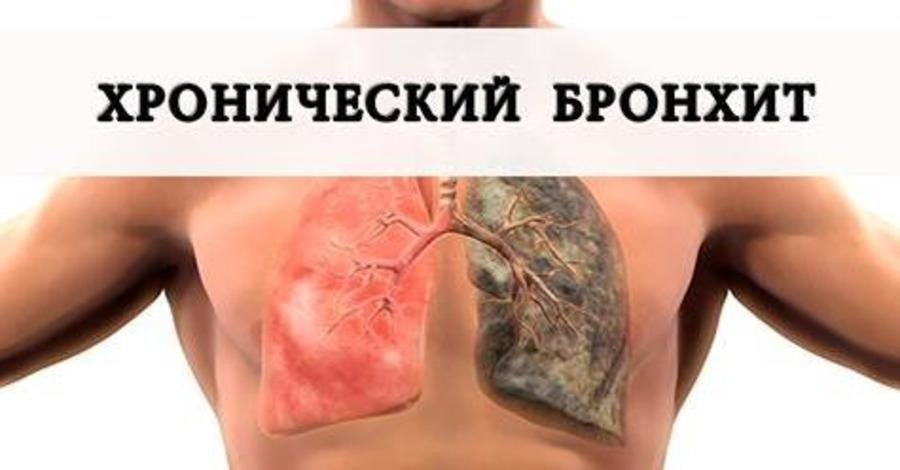 Этим методом можно побороть кашель и бронхит!