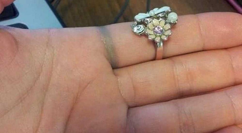 Что на самом деле означает, если серебро чернеет на теле