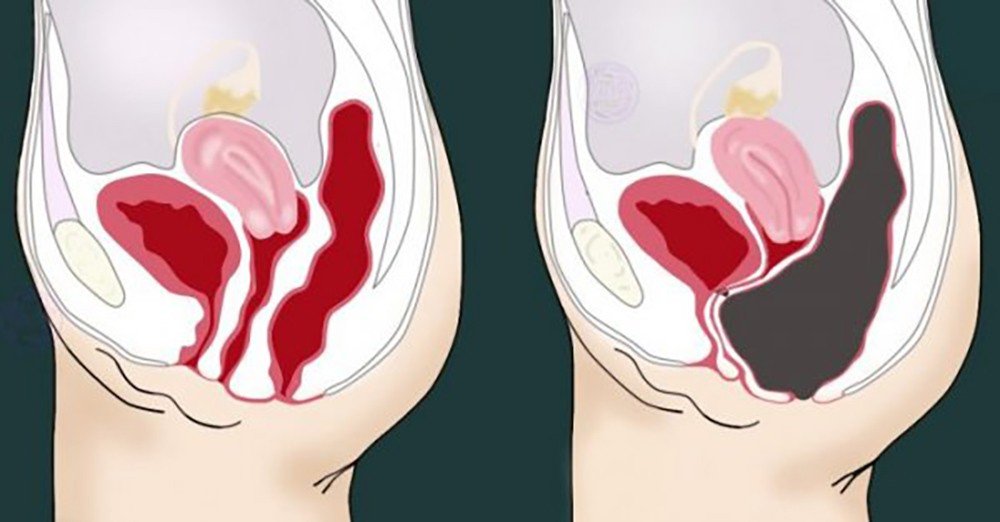 Употребляя этот напиток в течении 2 недель, вы избавитесь от головных болей, усталости, забывчивости, токсинов и не только!