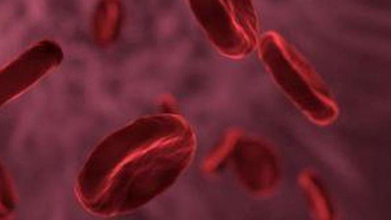 Названы опасные симптомы, указывающие на тромб