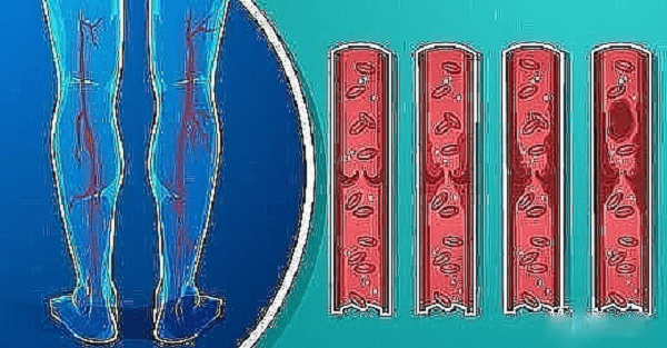 Как разжижить густую кровь: 7 продуктов, которые кардиологи рекомендуют употреблять