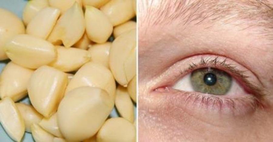 Как восстановить зрение с помощью чеснока. Без операций!