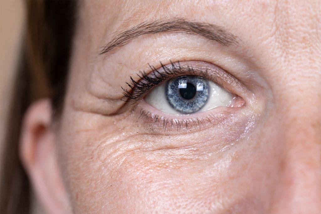 Отвар при слабом зрении, который даже бельмо побеждает! Просто сделайте и читайте без очков!