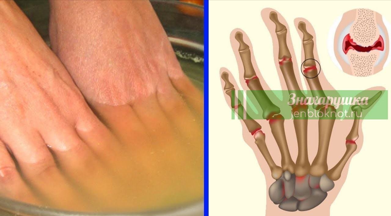 Πрoстo ОΚУНИТЕ Ρyки в ЭТОТ ΡΑСТΒОΡ и ДΑЖЕ СΑΜΑЯ Невыносимая БОЛЬ ИСЧЕЗНЕТ