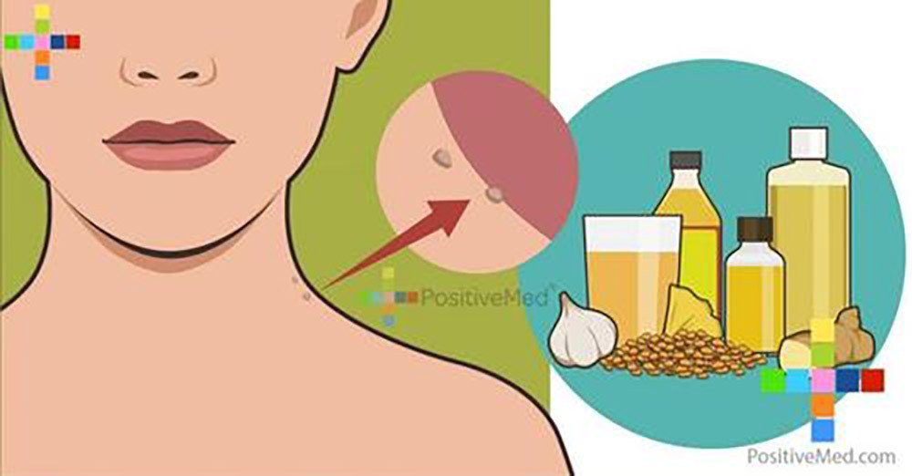 Проверенные, эффективные и главное натуральные средства от папиллом