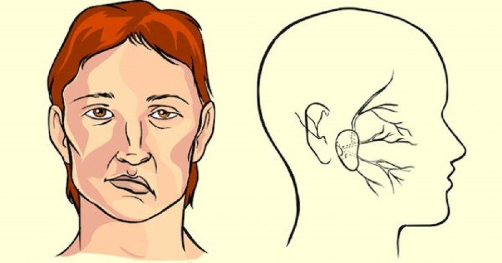 Нетрадиционный, но очень эффективный метод спасения от инсульта.