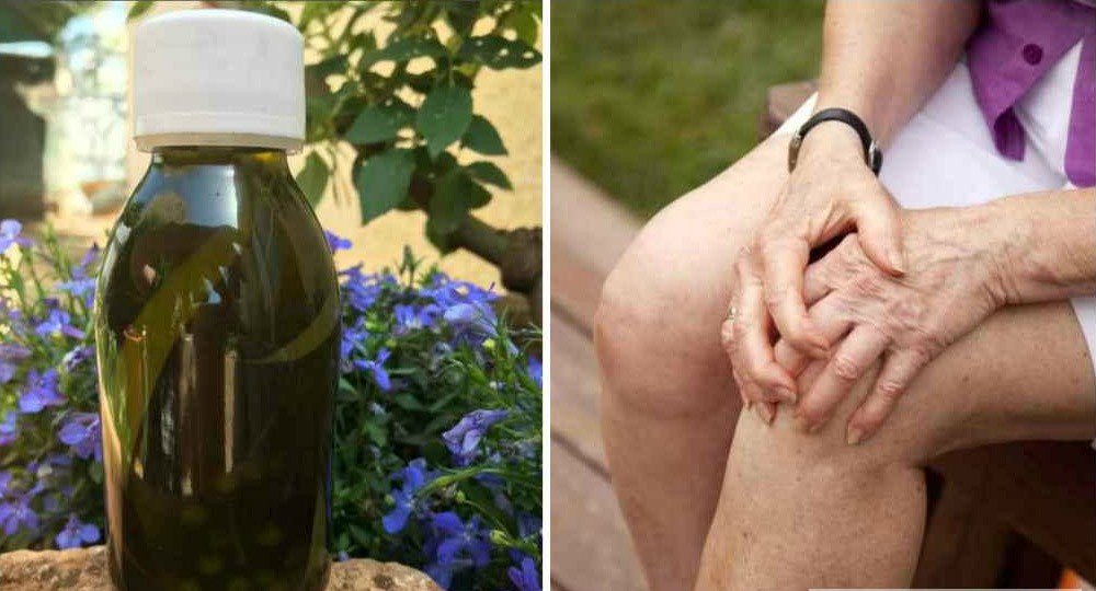 Дедова настойка спасла мне колени — боль ушла, и не возвращается!