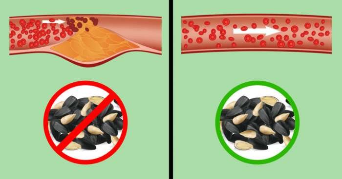 Что происходит с организмом, когда вы часто едите семечки (И правда ли, что они провоцируют аппендицит)