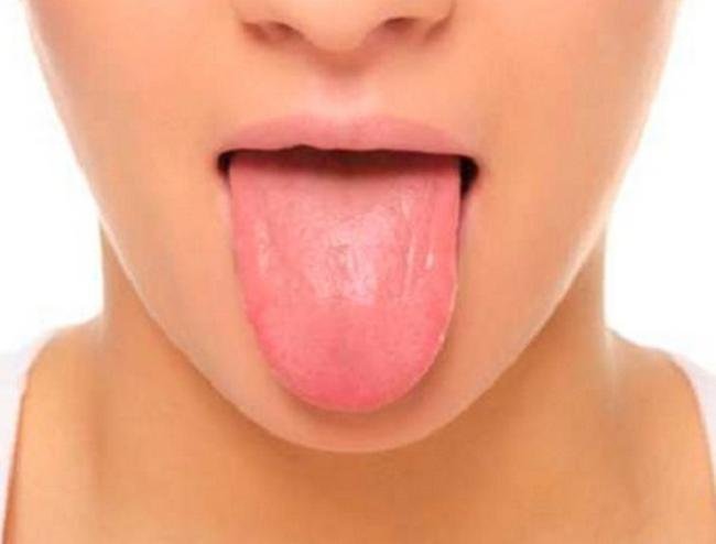 Язык — зеркало организма. Узнай о своих проблемах, чтобы избежать негативных последствий.